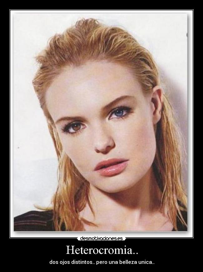 Heterocromia.. - dos ojos distintos.. pero una belleza unica..