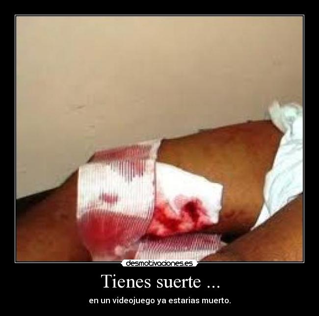 Tienes suerte ... - en un videojuego ya estarias muerto.