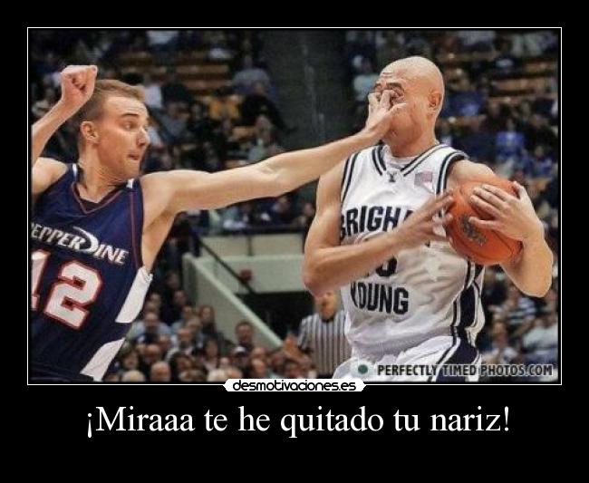 ¡Miraaa te he quitado tu nariz! - 