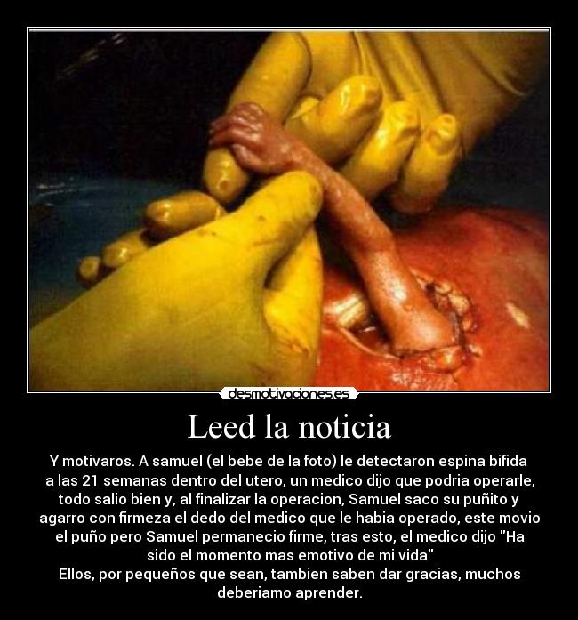 Leed la noticia -
