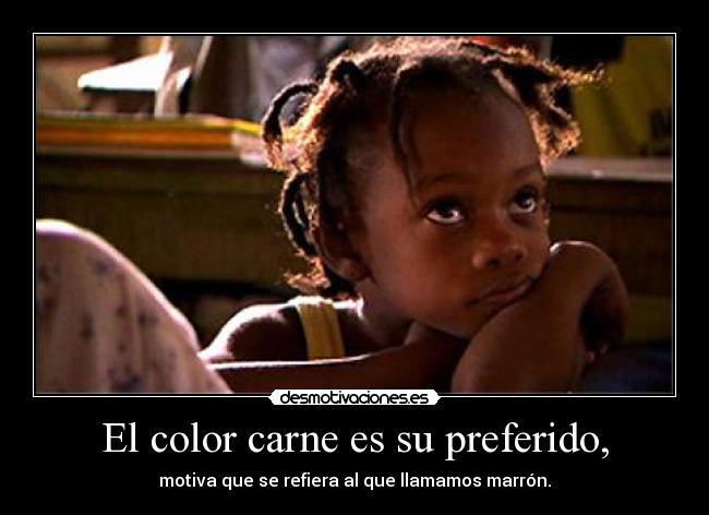 El color carne es su preferido, - 