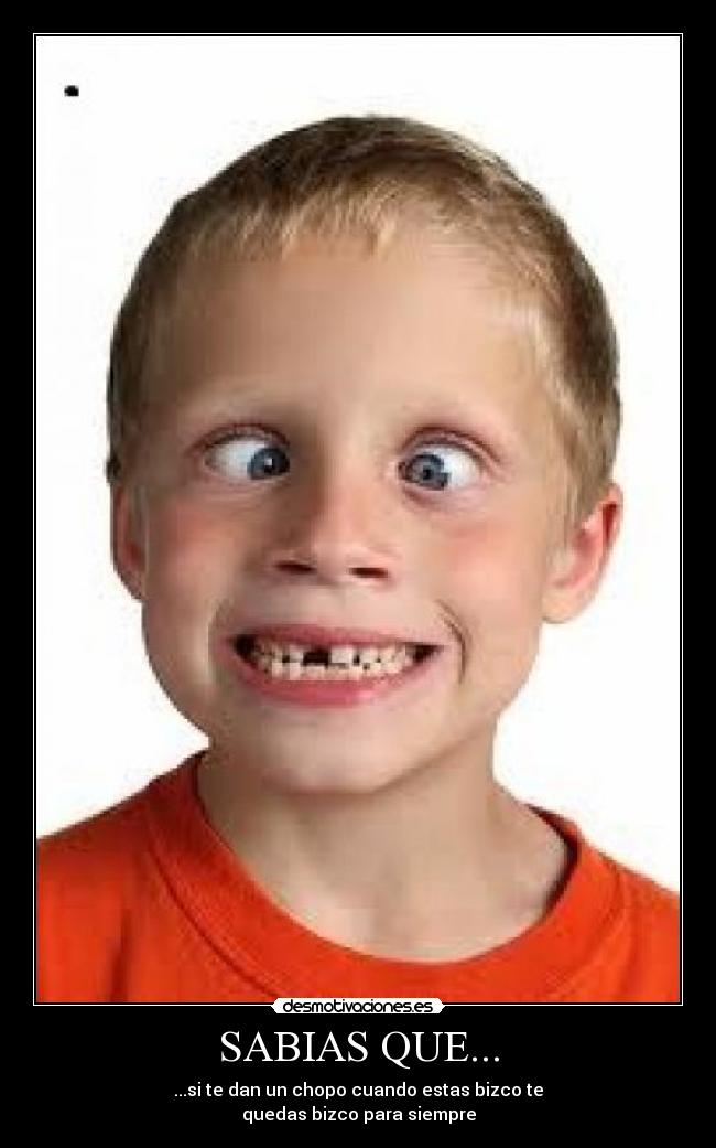 SABIAS QUE... - ...si te dan un chopo cuando estas bizco te
quedas bizco para siempre