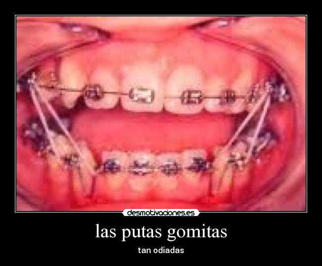 las putas gomitas - 