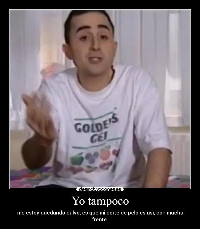 Yo tampoco - me estoy quedando calvo, es que mi corte de pelo es así, con mucha frente.