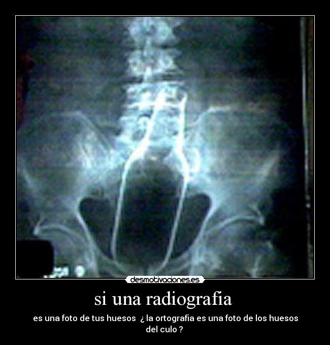 si una radiografia - es una foto de tus huesos ¿ la ortografia es una foto de los huesos del culo ?