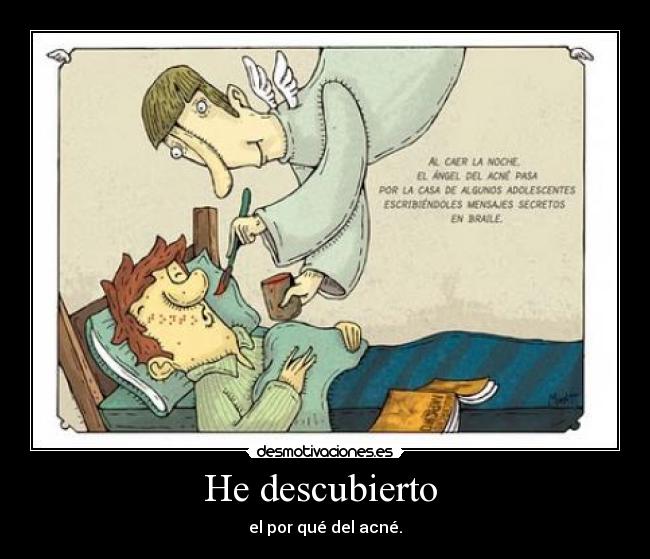 He descubierto - el por qué del acné.