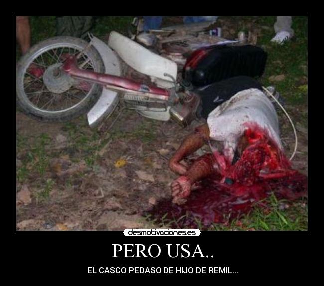 PERO USA.. - EL CASCO PEDASO DE HIJO DE REMIL...