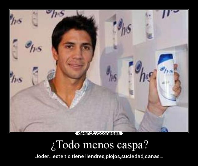 ¿Todo menos caspa? - Joder...este tio tiene liendres,piojos,suciedad,canas...