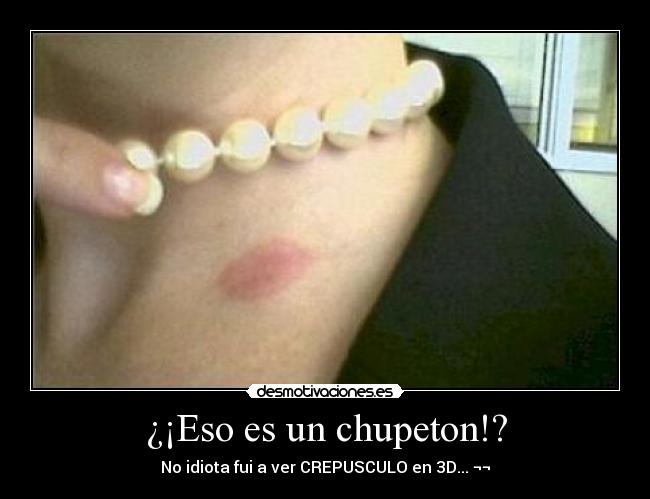 ¿¡Eso es un chupeton!? -