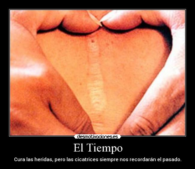 El Tiempo - Cura las heridas, pero las cicatrices siempre nos recordarán el pasado.