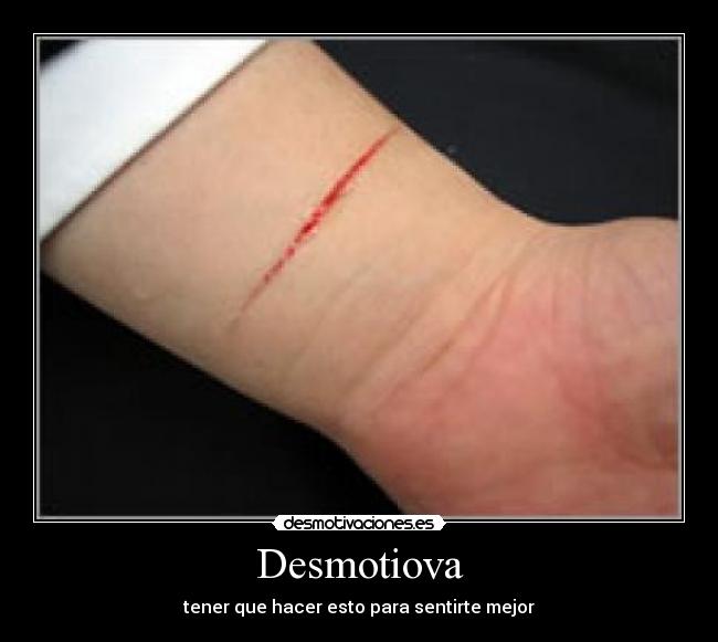 Desmotiova - tener que hacer esto para sentirte mejor