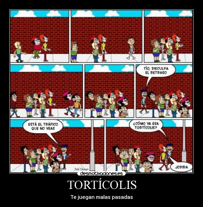 TORTÍCOLIS -