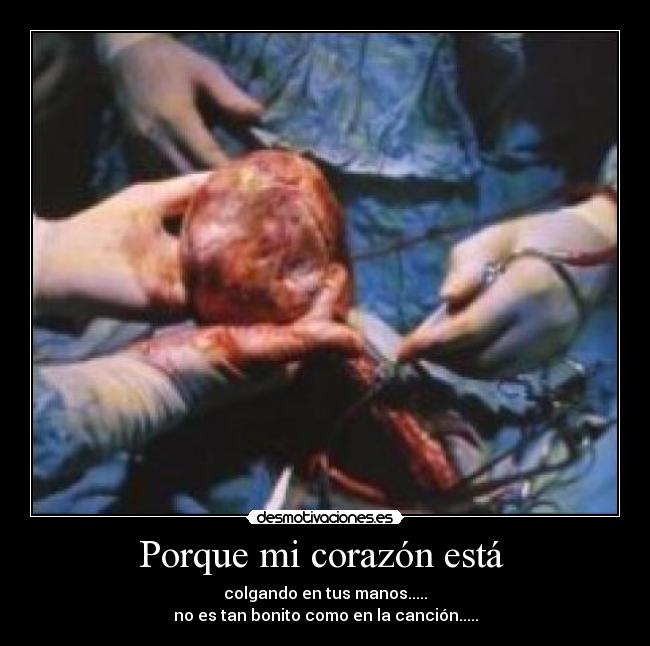 Porque mi corazón está  - 