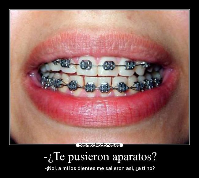 -¿Te pusieron aparatos? - 
