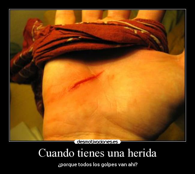 Cuando tienes una herida -