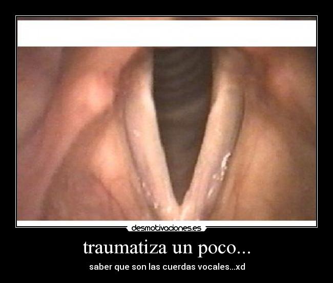 carteles lololo_123 desmotivaciones