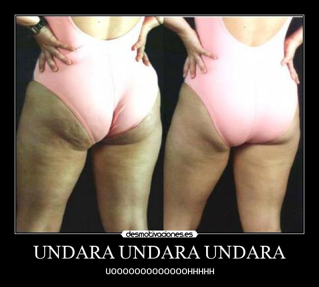 UNDARA UNDARA UNDARA - UOOOOOOOOOOOOOHHHHH