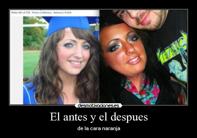 El antes y el despues - de la cara naranja