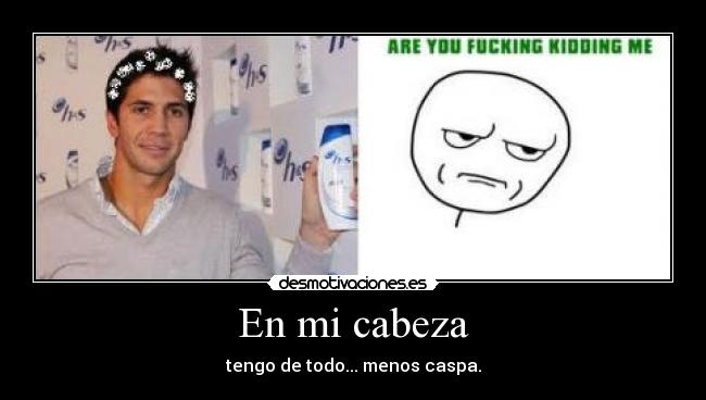 En mi cabeza - tengo de todo... menos caspa.
