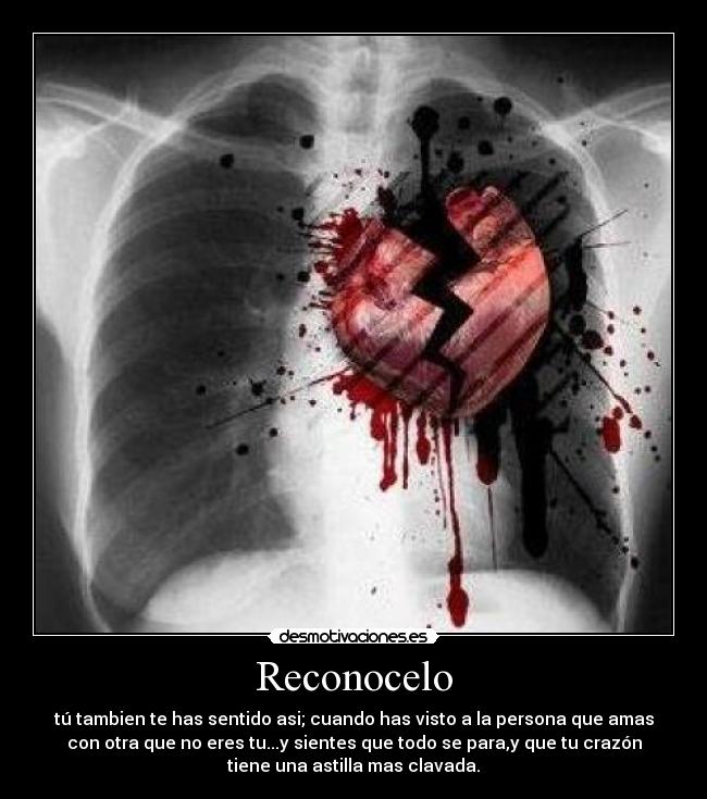 Reconocelo -