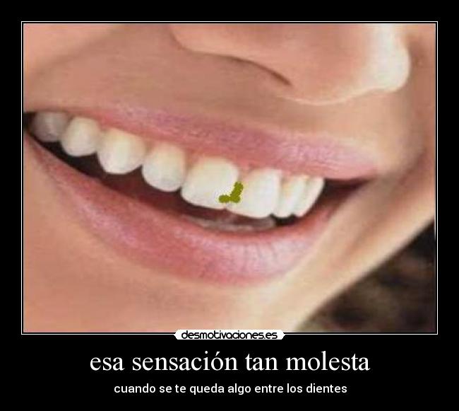 esa sensación tan molesta - cuando se te queda algo entre los dientes