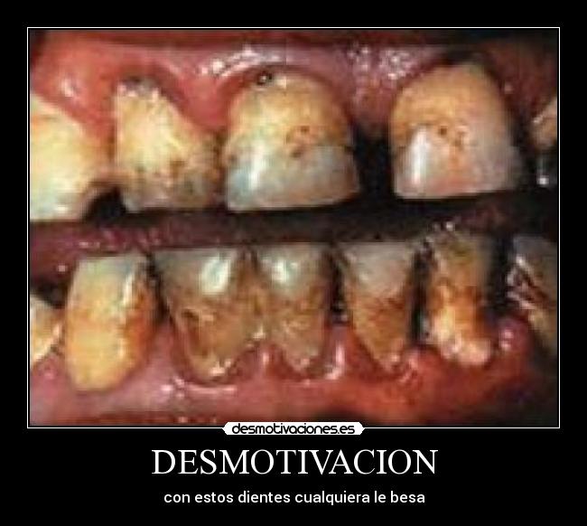 DESMOTIVACION -