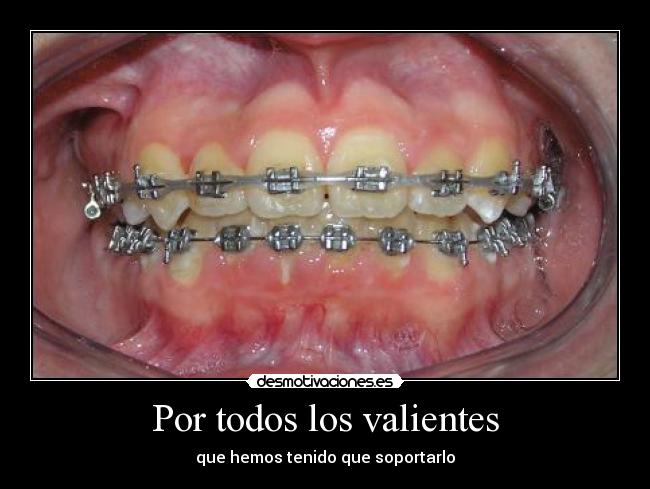 Por todos los valientes -