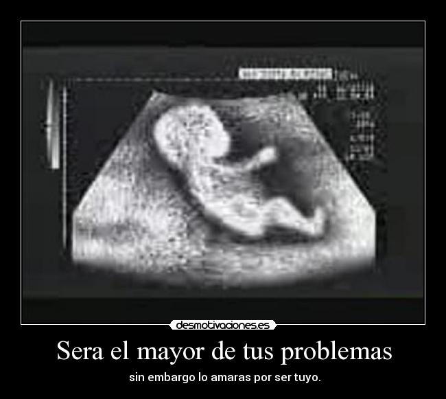 Sera el mayor de tus problemas - sin embargo lo amaras por ser tuyo.