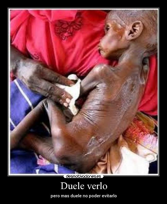 Duele verlo - 