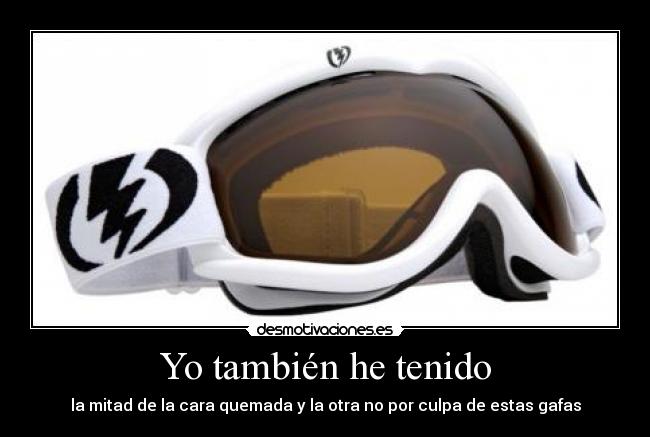 Yo también he tenido - 