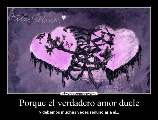 Porque el verdadero amor duele - 