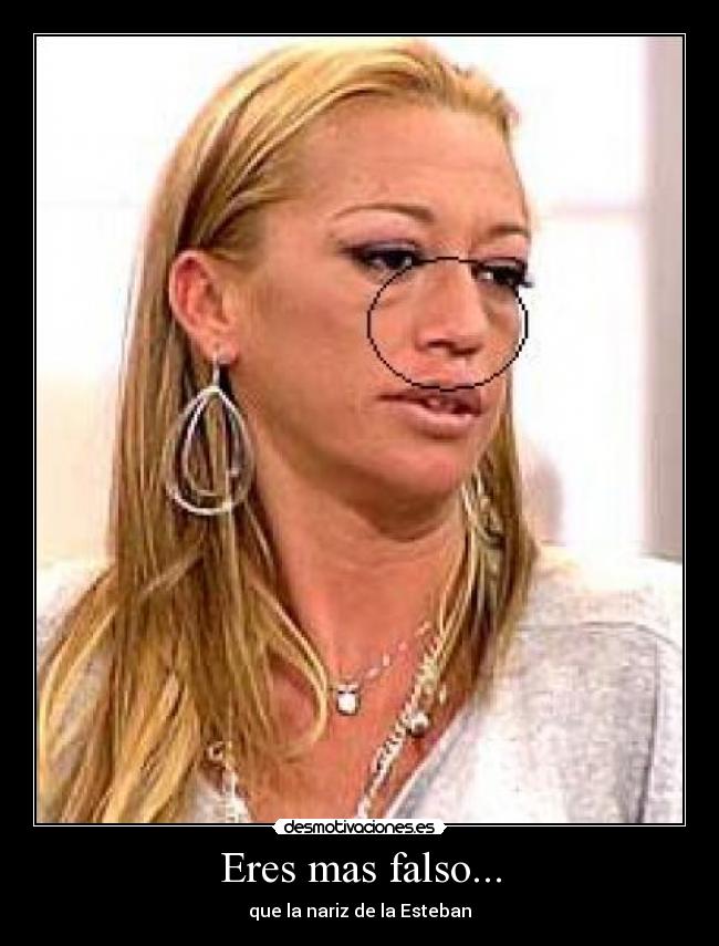 Eres mas falso... - que la nariz de la Esteban