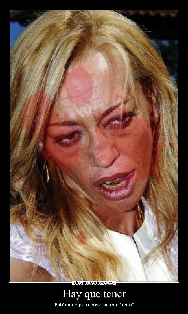 Hay que tener - Estómago para casarse con esto