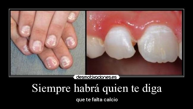 Siempre habrá quien te diga - que te falta calcio