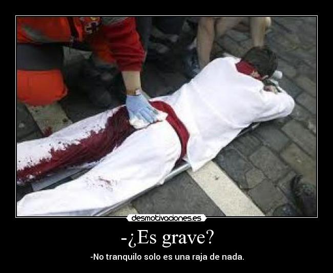 -¿Es grave? - -No tranquilo solo es una raja de nada.