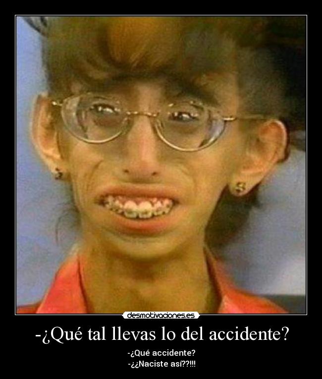 -¿Qué tal llevas lo del accidente? - 