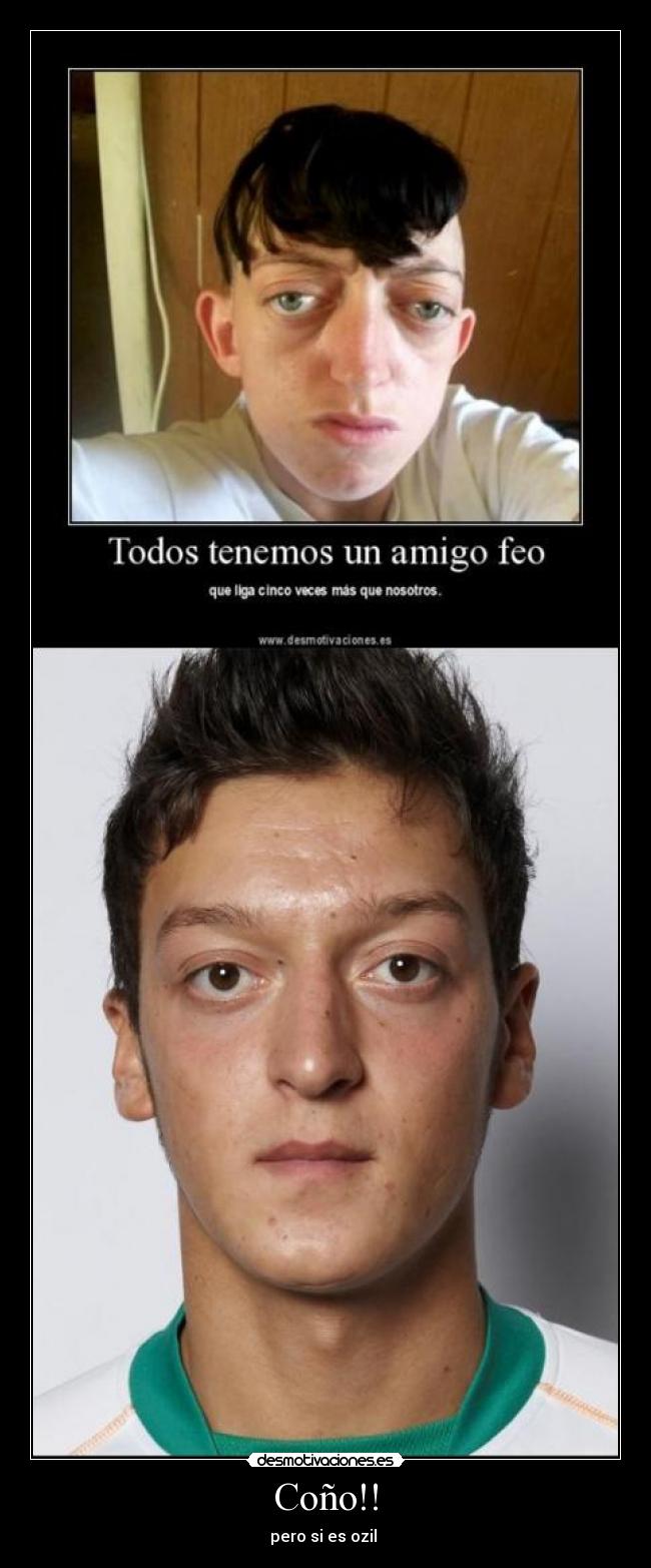 Coño!! - pero si es ozil 