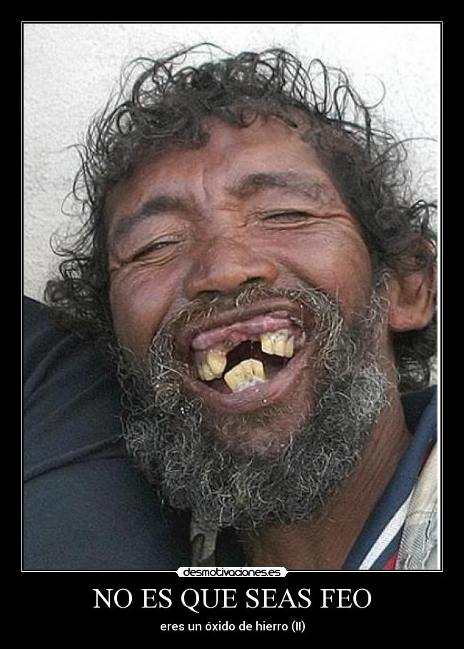 NO ES QUE SEAS FEO -