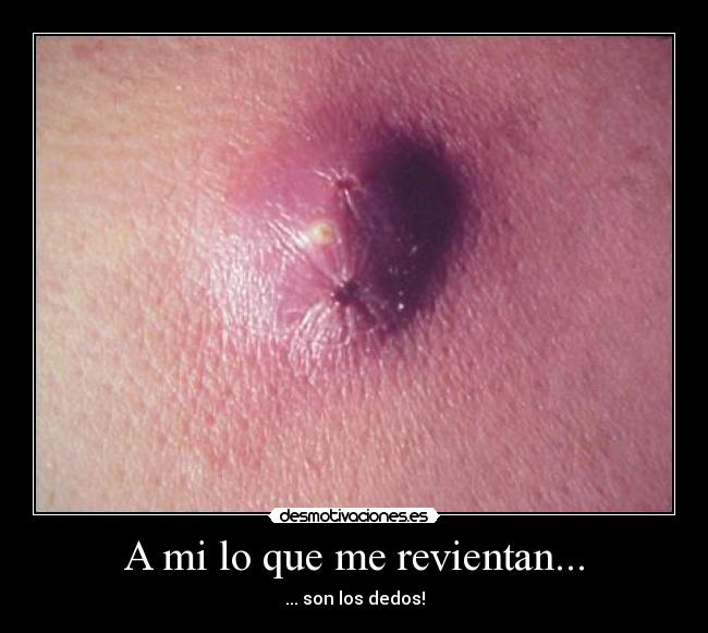 A mi lo que me revientan... -