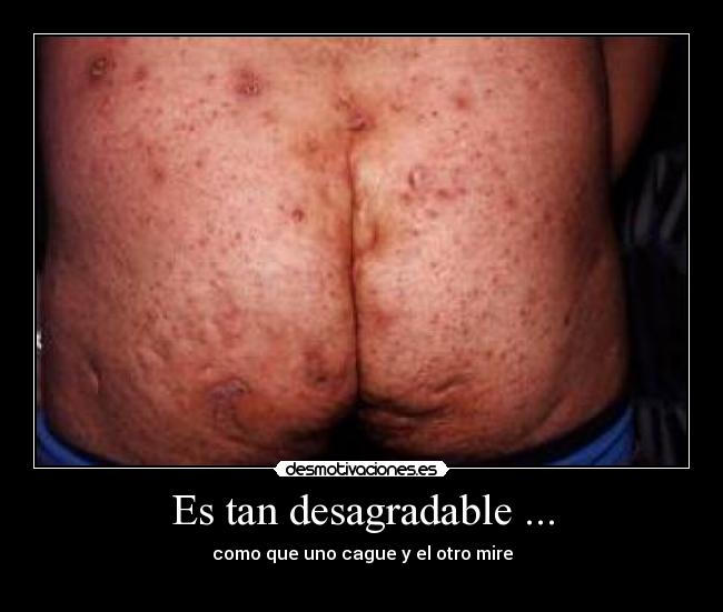 Es tan desagradable ... -