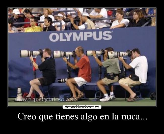 Creo que tienes algo en la nuca... -