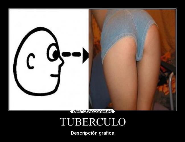 TUBERCULO -