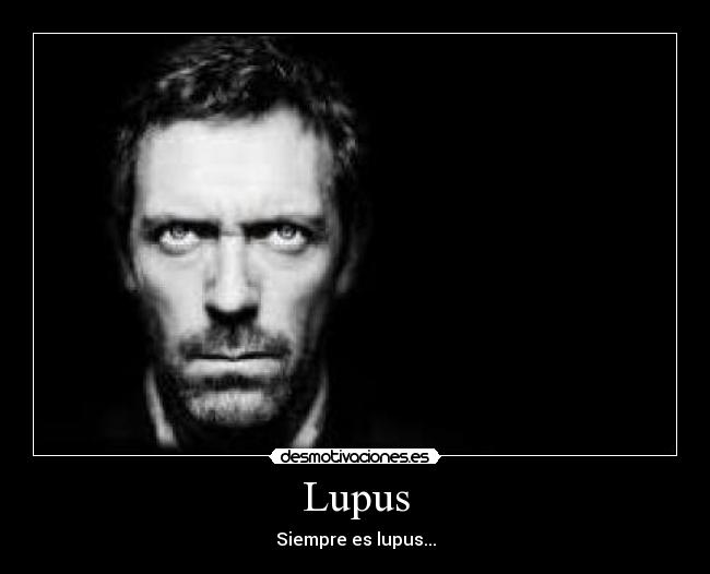 Lupus -