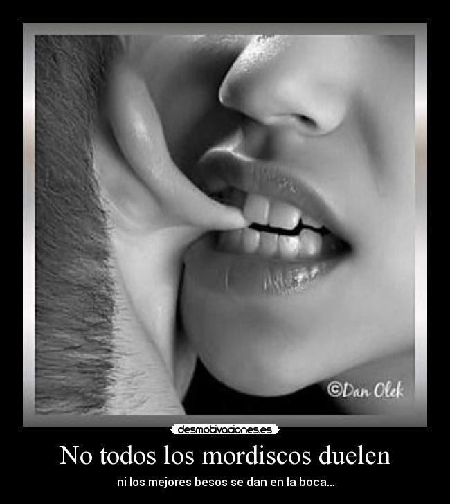 No todos los mordiscos duelen - ni los mejores besos se dan en la boca...