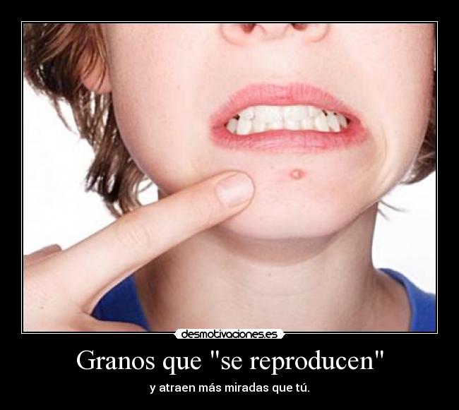 Granos que se reproducen - y atraen más miradas que tú.