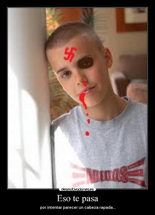 Eso te pasa - 