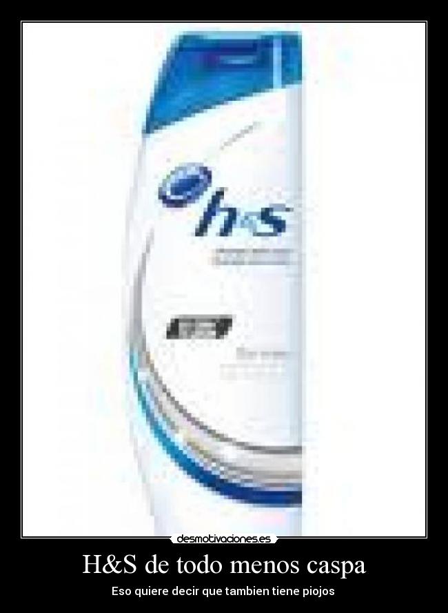 H&S de todo menos caspa - Eso quiere decir que tambien tiene piojos