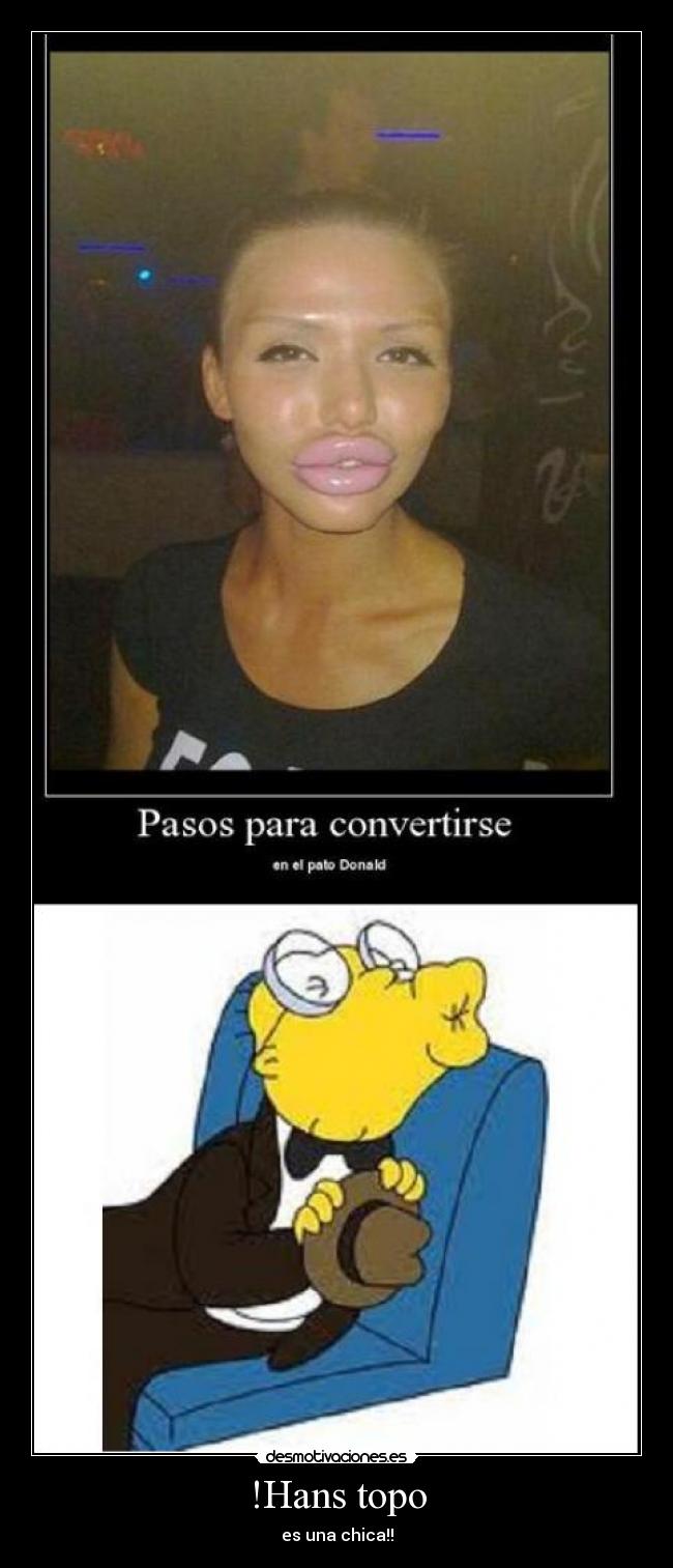 !Hans topo - es una chica!!