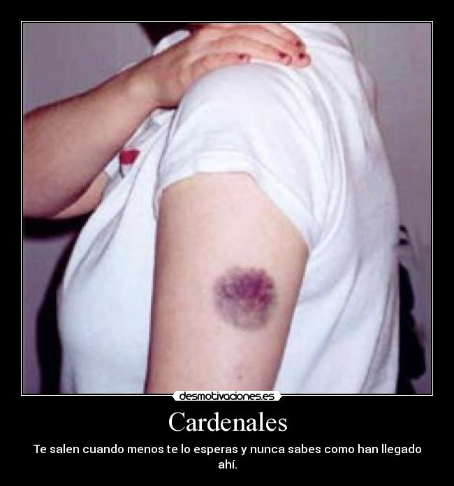 Cardenales -