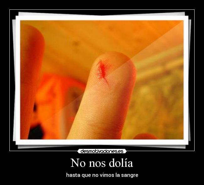 No nos dolía - hasta que no vimos la sangre